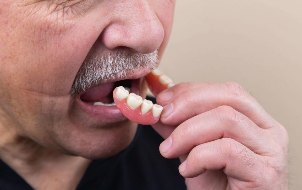 man-putting-in-dentures