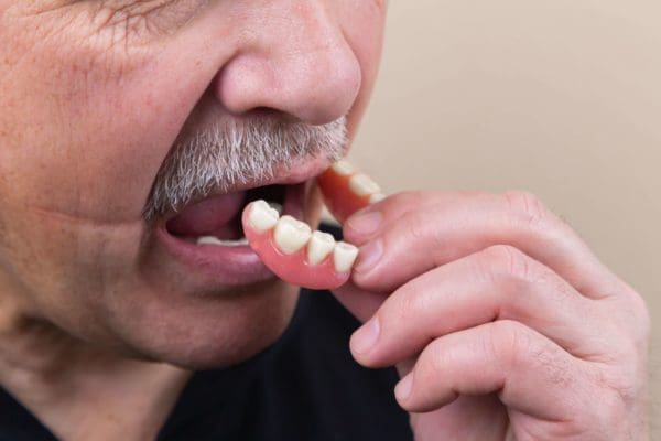 man-putting-in-dentures