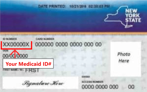 NY Medicaid card