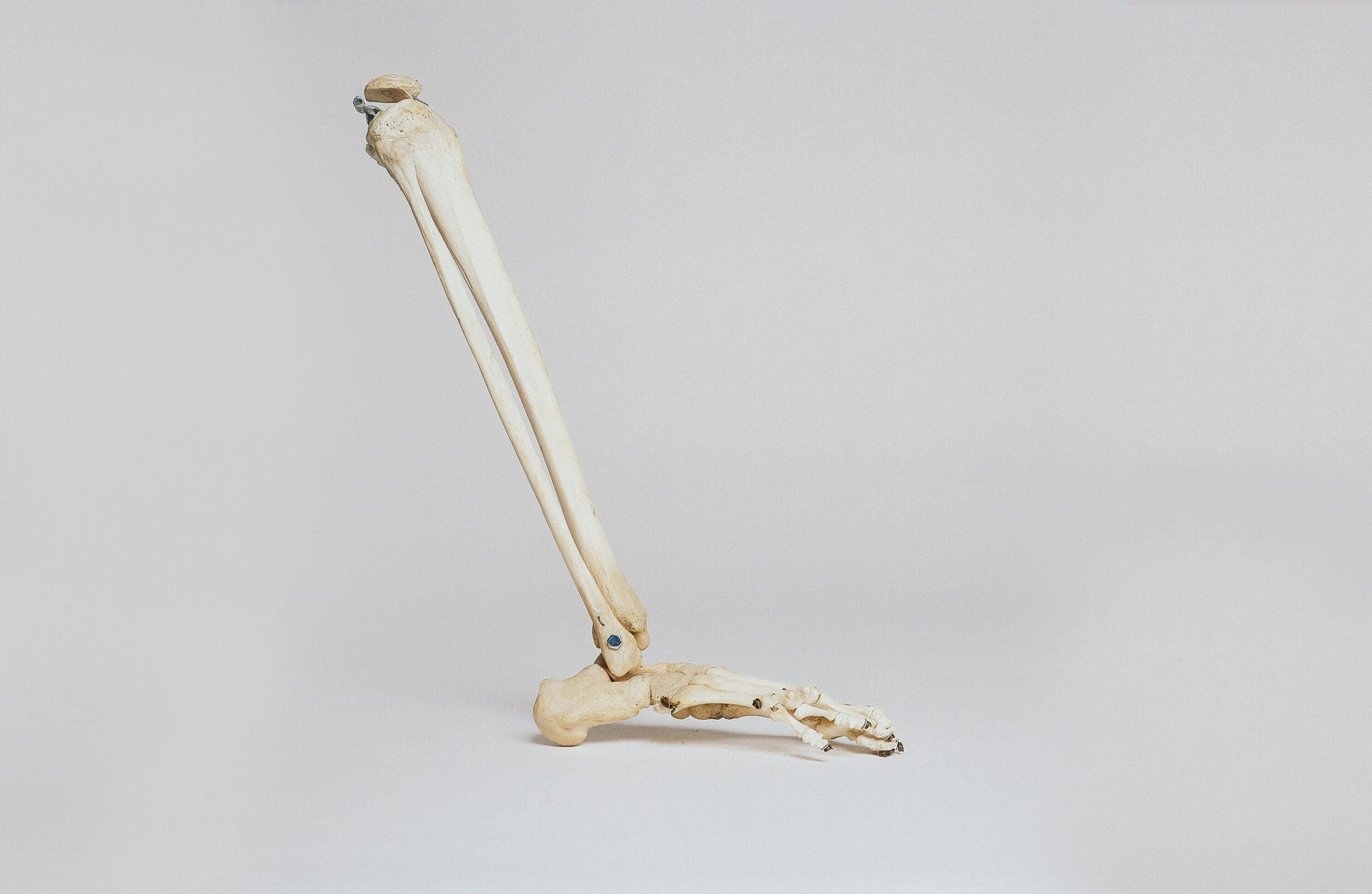 leg bones